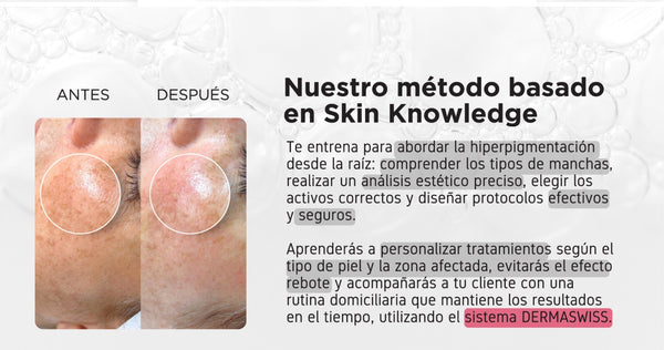 ORLANDO Masterclass Hiperpigmentación