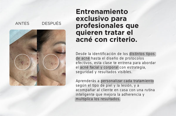 ORLANDO  Masterclass Acne